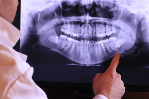 Best Emergency Treatment for Toothache in Portland, MI